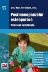 Postmenopauzální osteoporóza: praktické rady lékaře