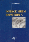 Infekce virem hepatitidy C