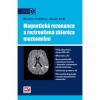 Magnetická rezonance a roztroušená skleróza mozkomíšní