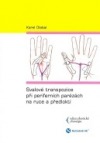 Svalové transpozice při periferních parézách na ruce a předloktí