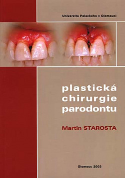 Plastická chirurgie parodontu