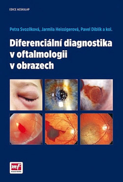 Diferenciální diagnostika v oftalmologii v obrazech