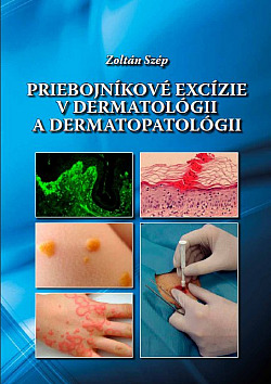 Priebojníkové excízie v dermatológii a dermatopatológii
