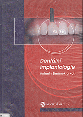 Dentální implantologie
