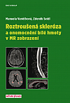 Roztroušená skleróza a onemocnění bílé hmoty v MR zobrazení