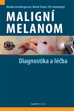 Maligní melanom – Diagnostika a léčba